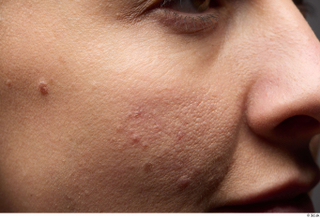 HD Face Skin Zolzaya cheek face nose skin pores skin…